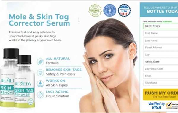 https://www.facebook.com/Remedy.Skin.Tag.Remover.Buy/