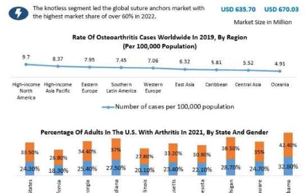 Global Suture Anchors Market Classification, Opportunities, Types, Applications, Business Strategies, Revenue and Growth