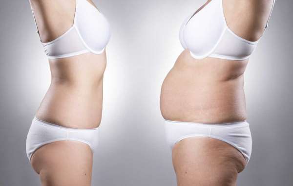 What Are The Advantages of Fat Loss Treatment?