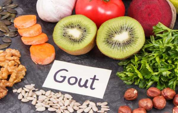 Exploring the Unexpected Link Between Gout-Friendly Diet and Cancer Prevention