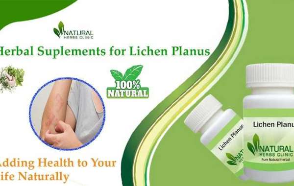 Lichen Planus Treatment at Home: Safe and Natural Remedies That Work!